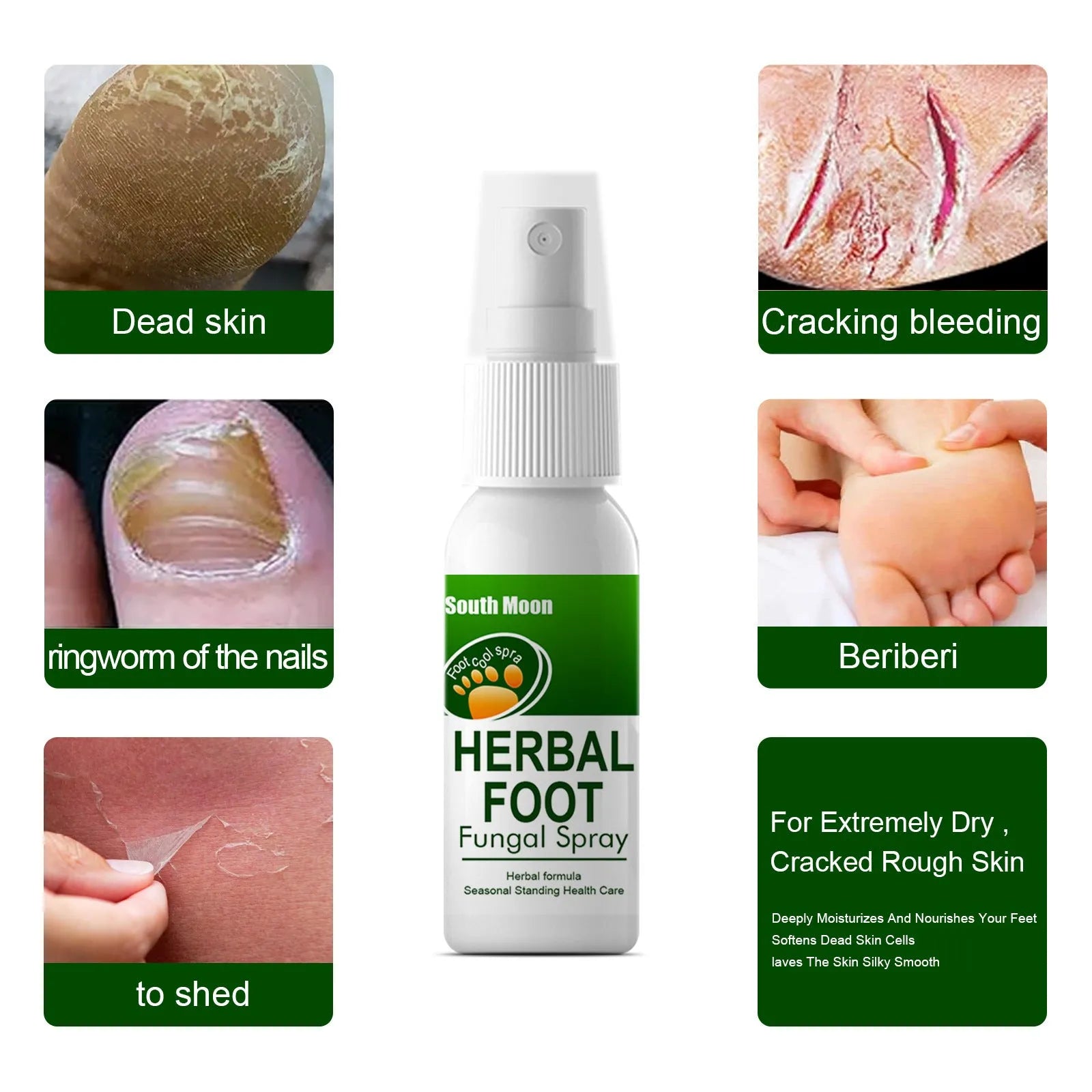 30ml foot hydrating care spray bottle for nourishing foot skin treatment