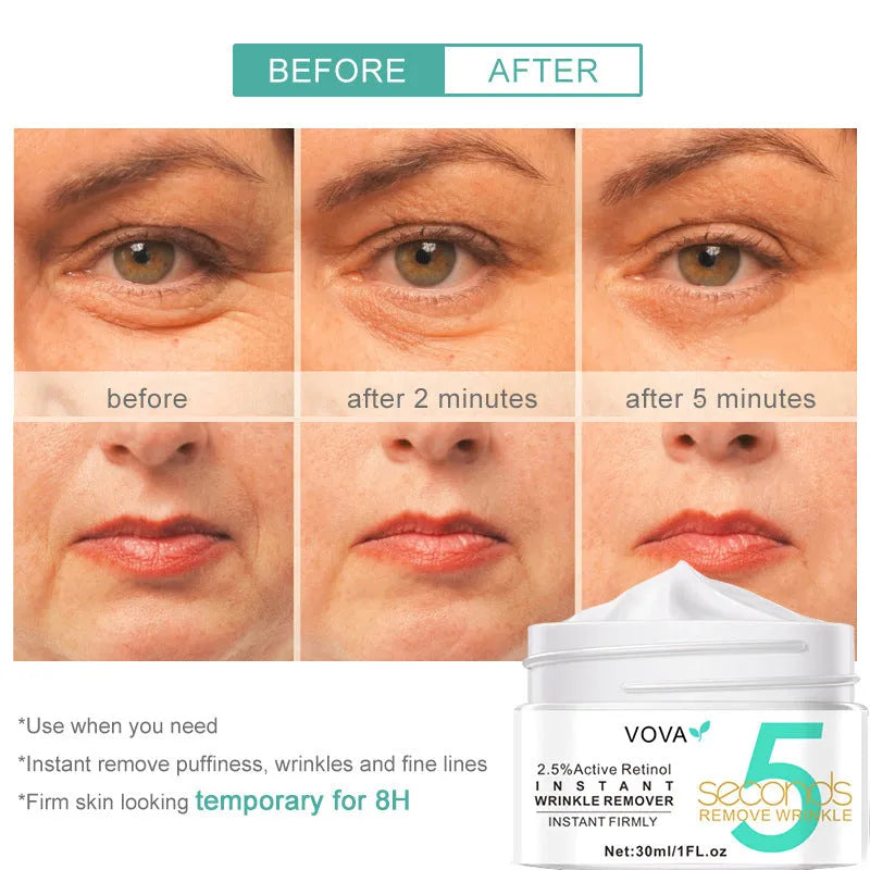VOVA Active Retinol Face Cream 30ml moisturising lotion cream with witch hazel in Photo Color tube