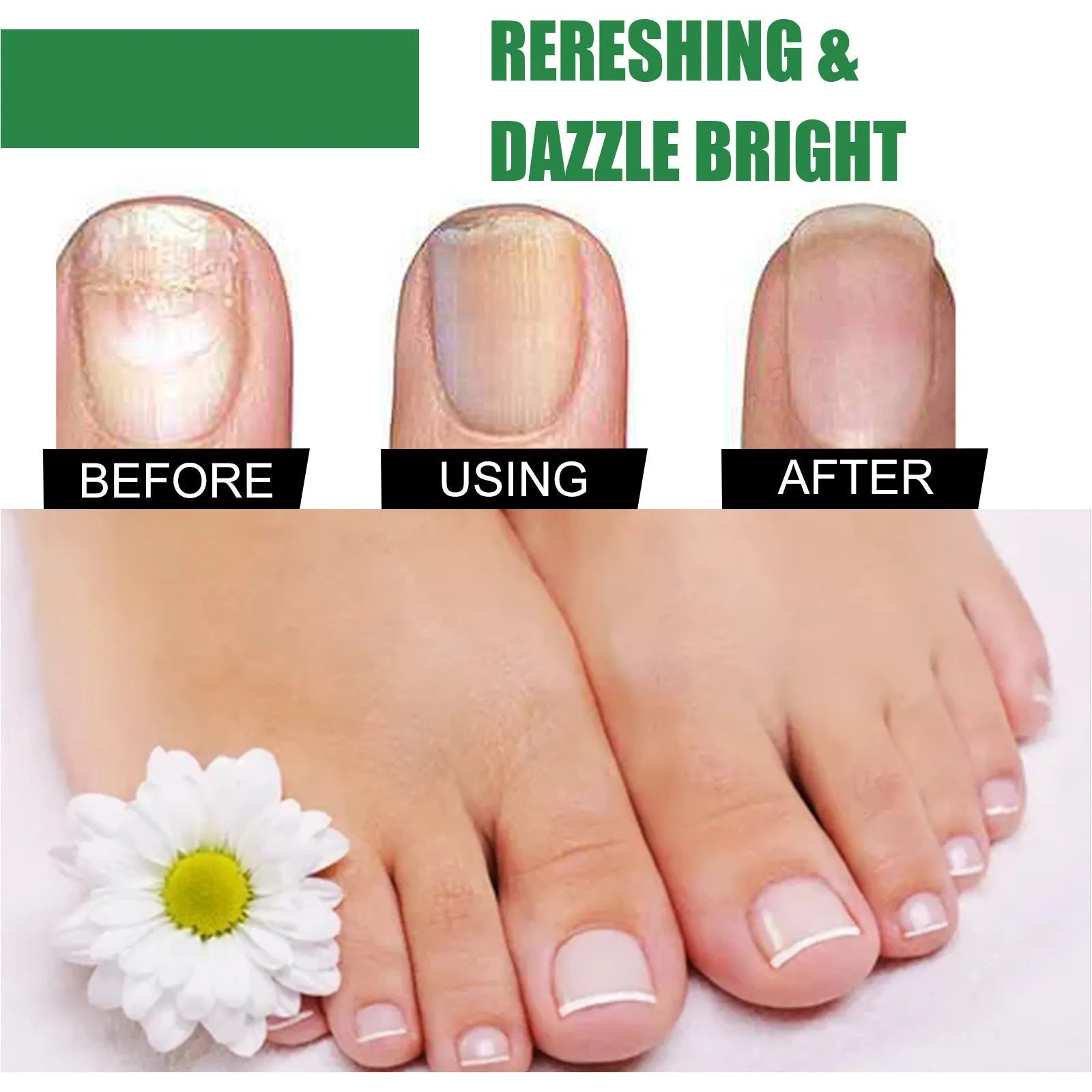 30ml tea tree oil foot and hand nail treatment bottle for brittle nail care