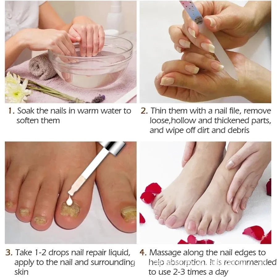 Jiagou 10ml whitening nail antimicrobial foot treatment liquid bottle