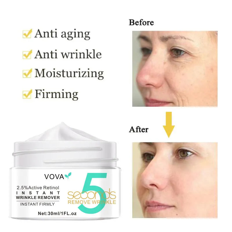 VOVA Active Retinol Face Cream 30ml moisturising lotion cream with witch hazel in Photo Color tube