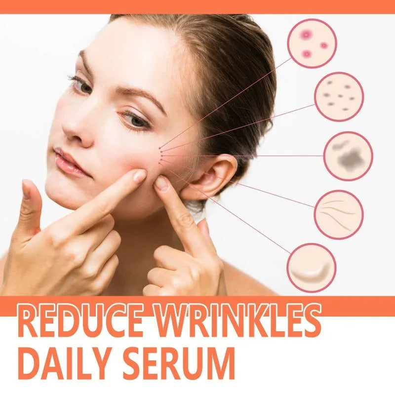30ml rose essential oil bottle for facial wrinkle smoothing and skin brightening
