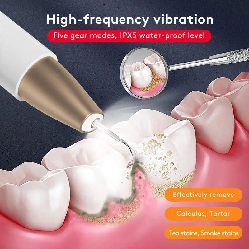 Gold ultrasonic tooth cleaner device for tartar removal and stain reduction at home