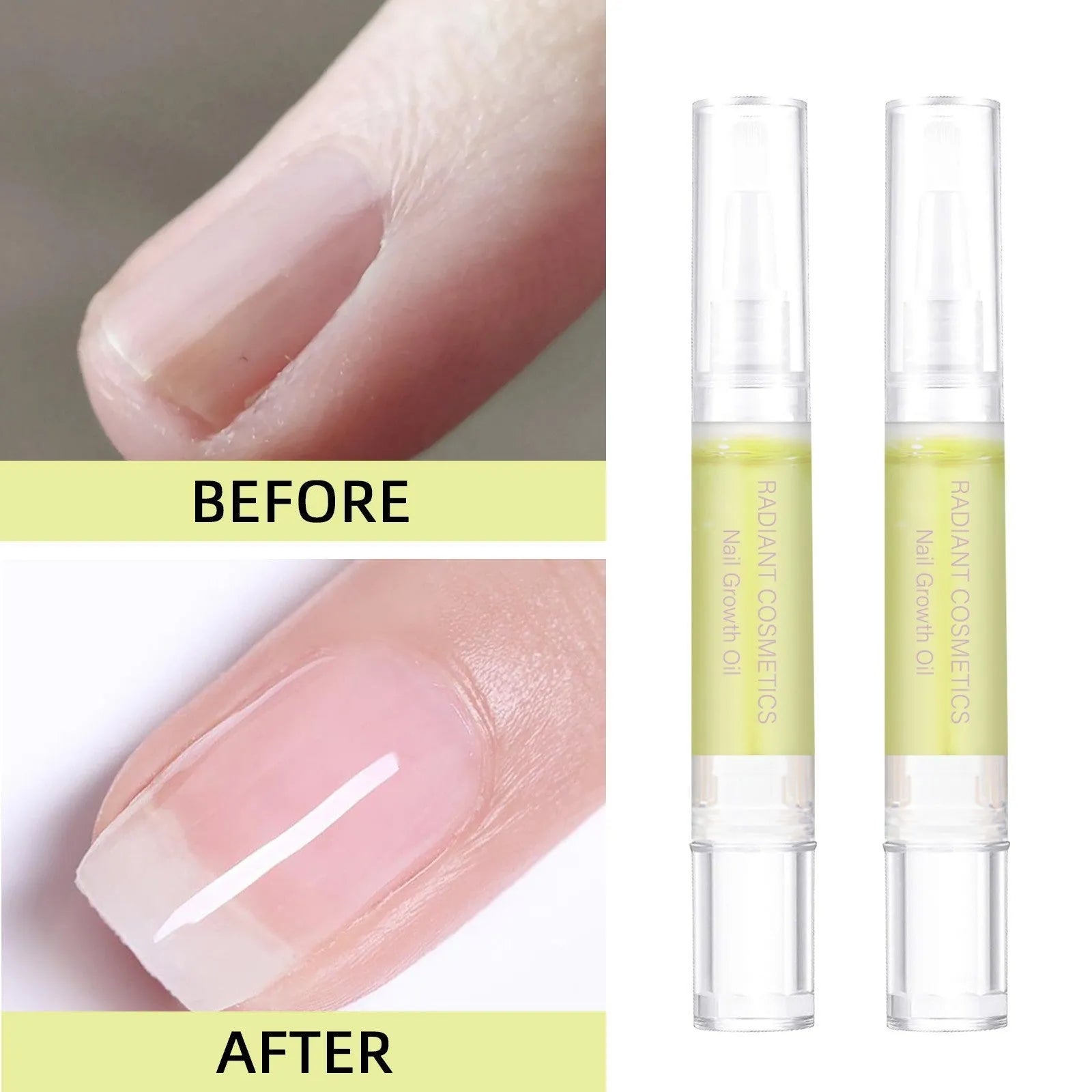 3ml bottle of wash-free nail growth treatment oil for promoting growth and moisturising