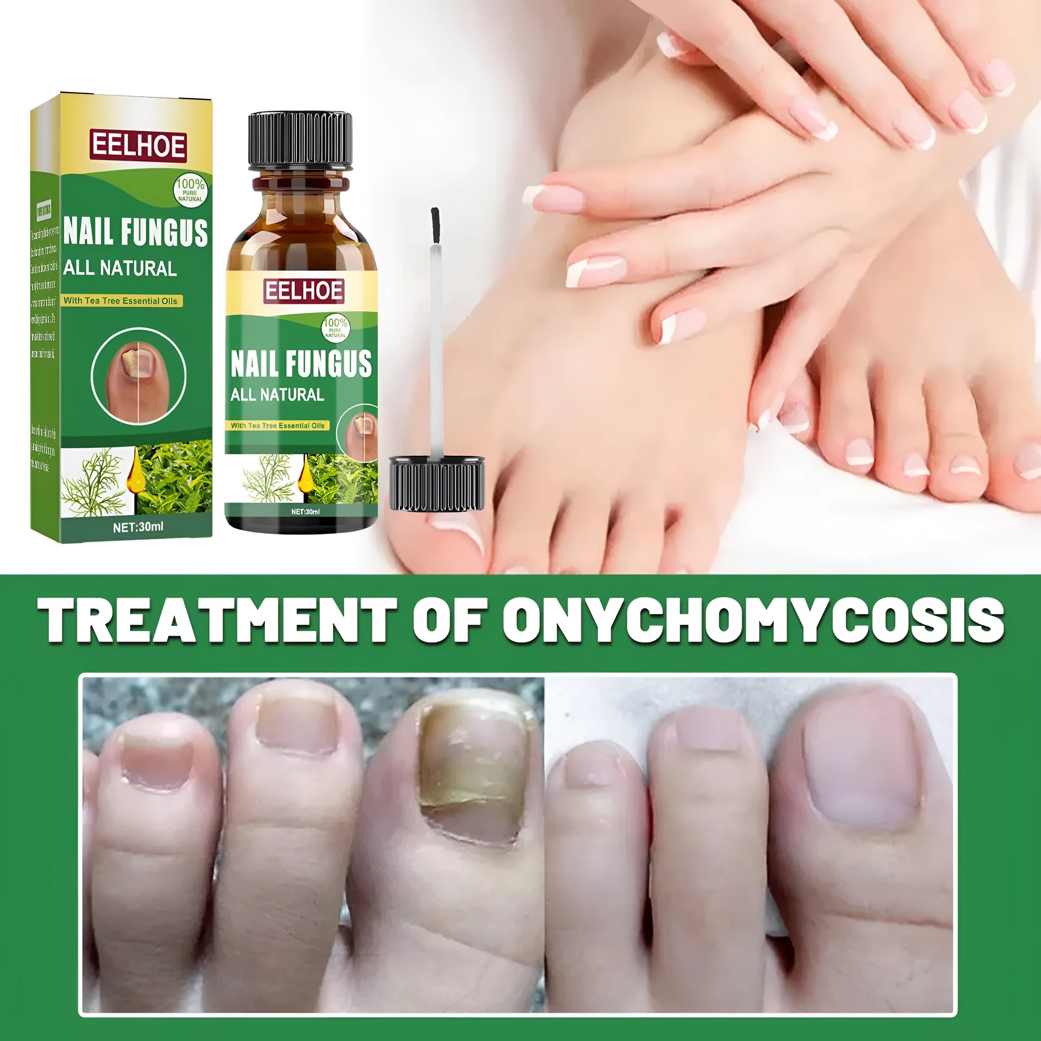30ml tea tree oil foot and hand nail treatment bottle for brittle nail care