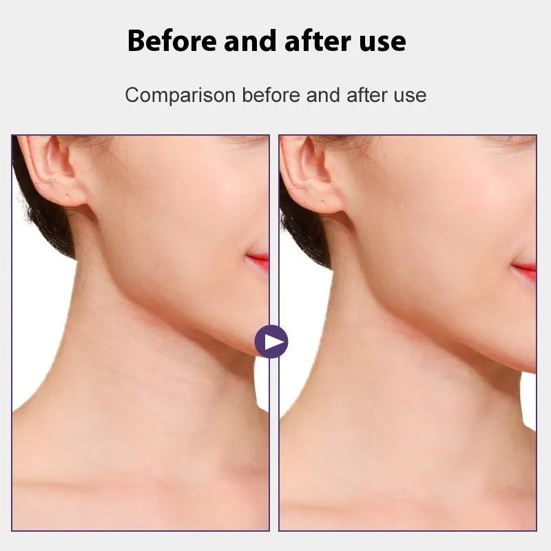 V27 neck pattern sling adhesive tape for invisible skin tone neck firming with medical-grade patches