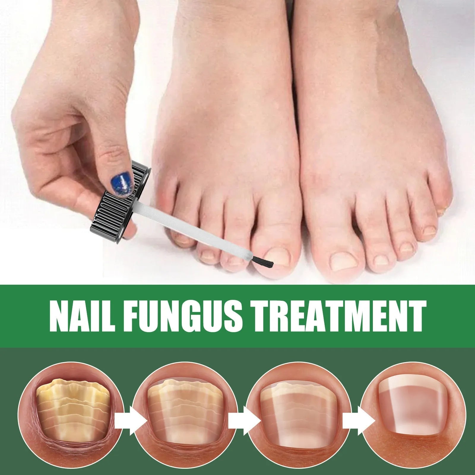 30ml tea tree oil foot and hand nail treatment bottle for brittle nail care
