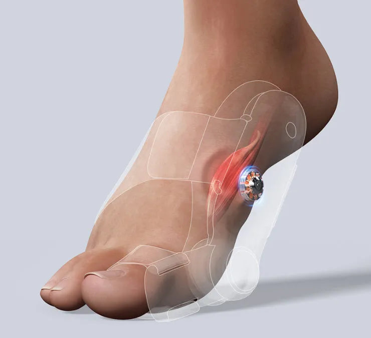 White plastic electric adjustable hallux valgus toe separator with Type-C charging port.