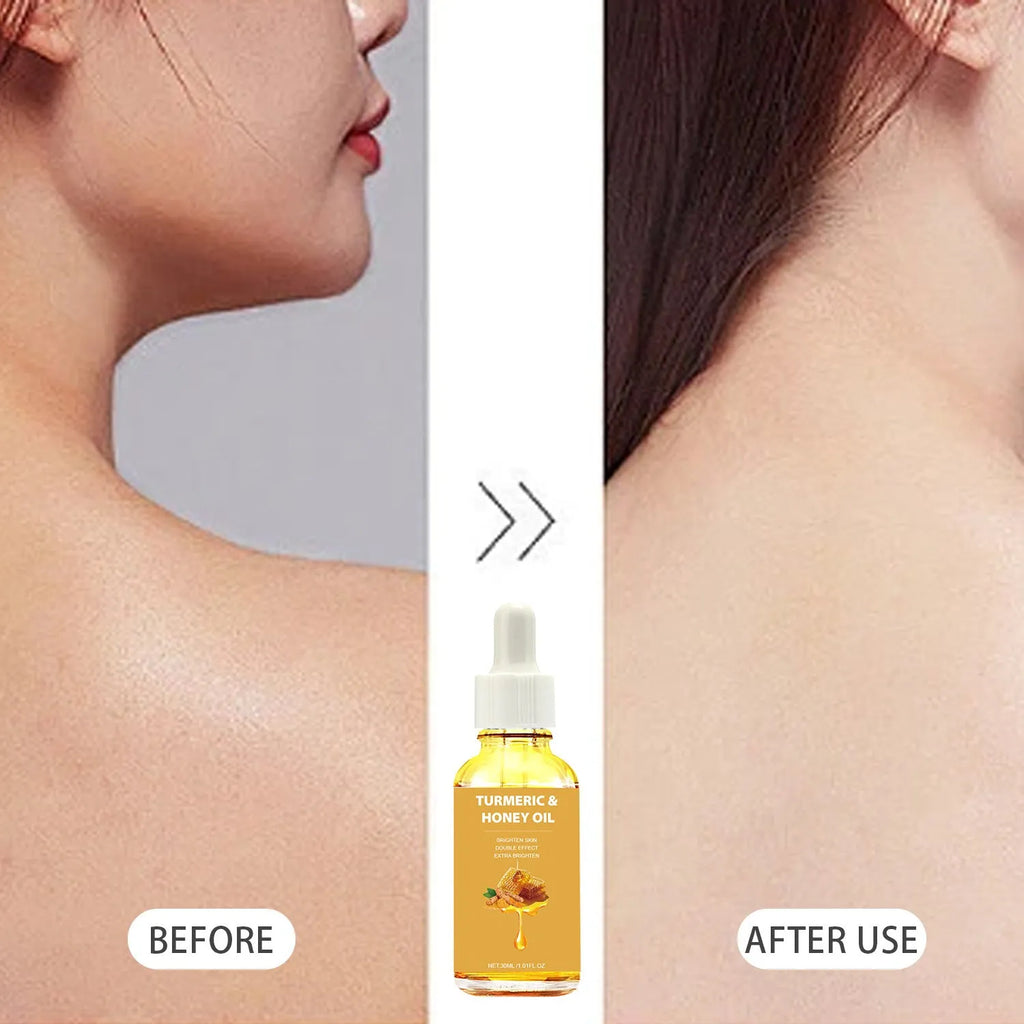 30ml amber glass bottle of turmeric honey essential oil with dropper for facial application
