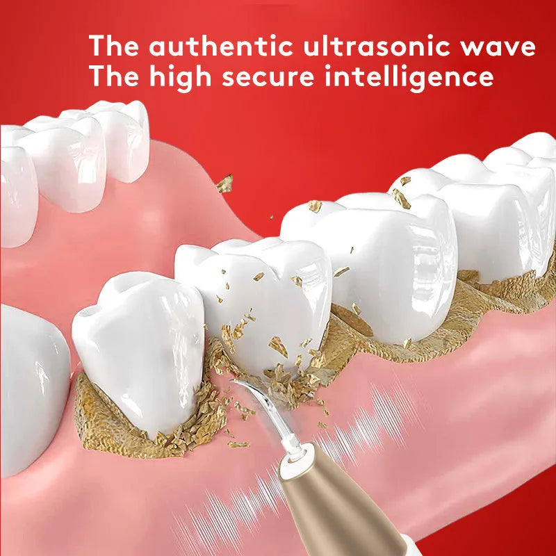 Gold ultrasonic tooth cleaner device for tartar removal and stain reduction at home